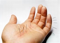 acupunturist-acupuncture-treatment-pain-brisbane-northside-10